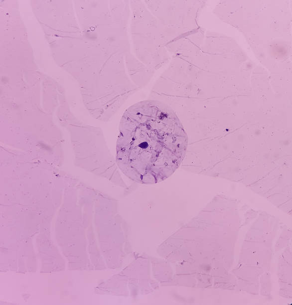 210+ Fotos, Bilder und lizenzfreie Bilder zu Lipoma Fotos iStock