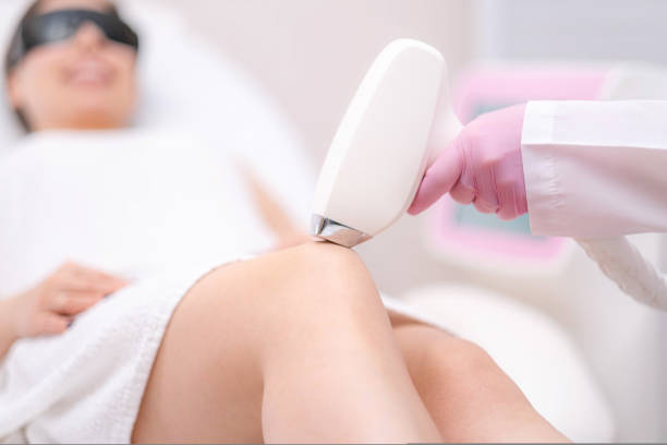 depilación láser de diodo, esteticista elimina el vello en hermosas piernas femeninas, depilación para una piel suave, procedimiento láser en estudio de belleza o clínica, tratamiento de depilación para el cuidado corporal - depilación fotografías e imágenes de stock
