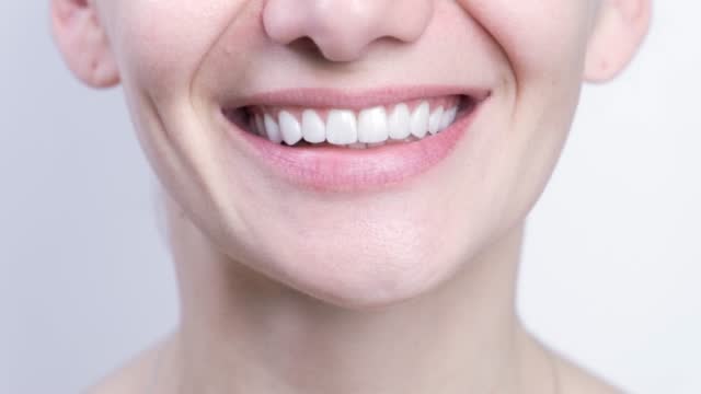 Perfect white teeth close up, female veneer smile, dental care and stomatology, dentistry.