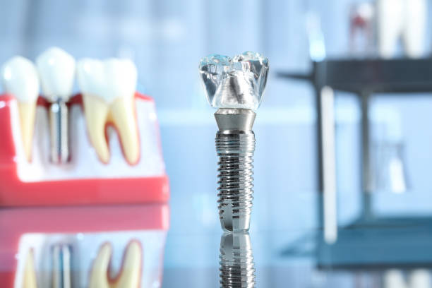 Dental zirconium implants for orthopedic screwdriver.
