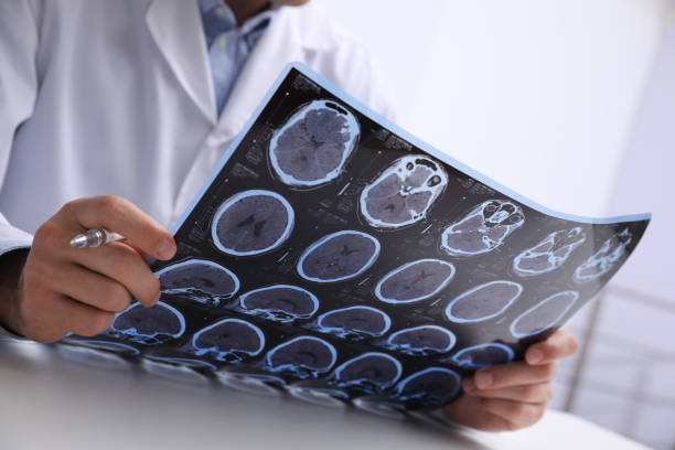 Doctor examining MRI images of patient with multiple sclerosis at table in clinic, closeup Doctor examining MRI images of patient with multiple sclerosis at table in clinic, closeup brain tumour stock pictures, royalty-free photos & images