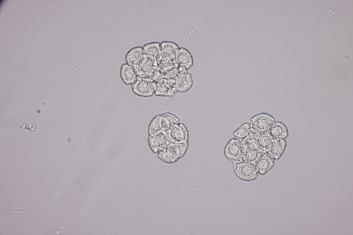 Eggs of helminth and Finding parasites in feces, analyze by microscope in laboratory.
