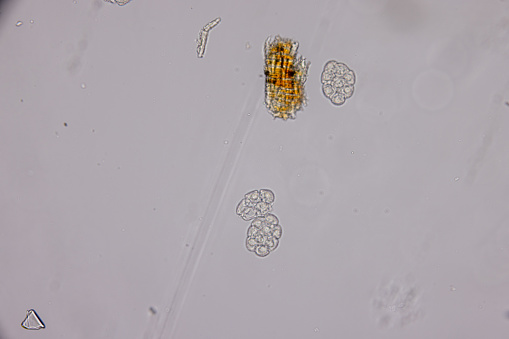 Eggs of helminth and Finding parasites in feces, analyze by microscope in laboratory.