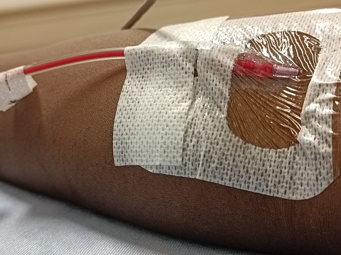Close up of IV during a blood transfusion