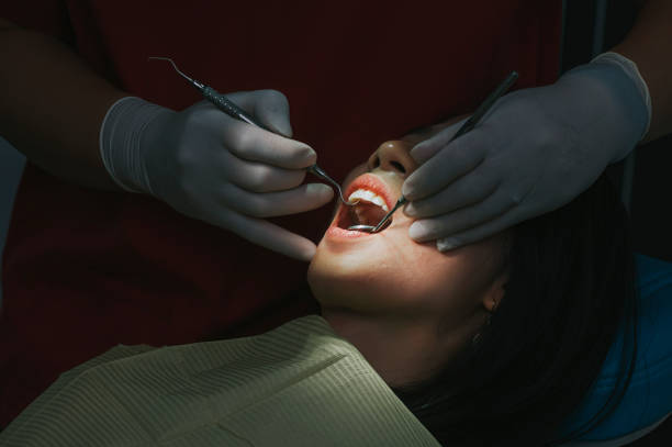 close up Asian Chinese female patient open mouth for dentist examining her tooth routine check up close up Asian Chinese female patient open mouth for dentist examining her tooth routine check up surgical light stock pictures, royalty-free photos & images