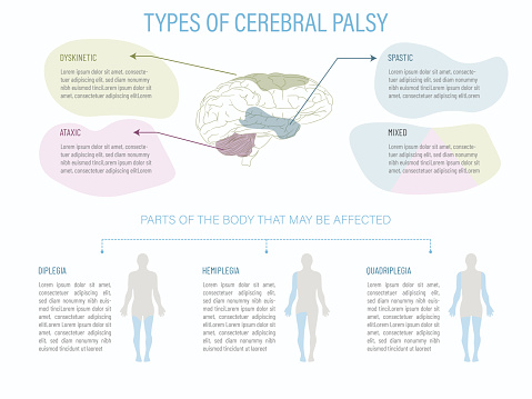 World Cerebral Palsy Day.Infographic with a brain and the parts affected by the different types of paralysis as well as what part of the body is affected by each type.