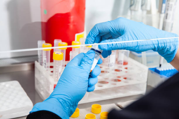 istock Scientist preparing blood samples for karyotipe and fluorescence in situ hybridization in the  laminar air flow cabinet. Blood sample preparation for diagnosis. Blood test. 1424013165