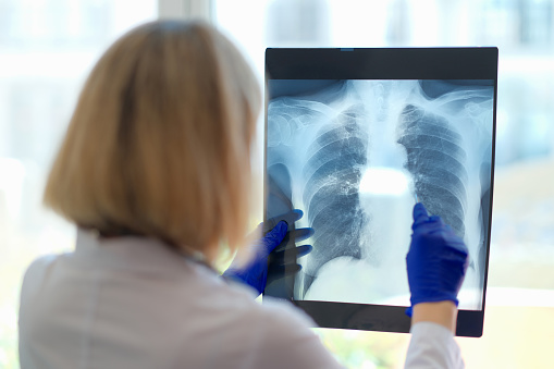 Doctor looks at x-ray in hospital. Medical specialist in radiology and medical sciences studies diseases. Expertise in medical care.