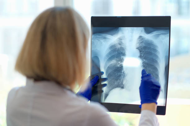 Doctor looks at x-ray in hospital. Medical specialist in radiology and medical sciences studies diseases stock photo