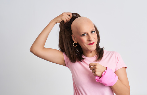Woman with cancer taking off her wig showing her hairless head