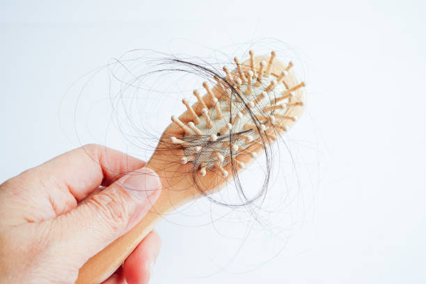 istock Hair loss fall with comb brush isolated on white background. 1424312644