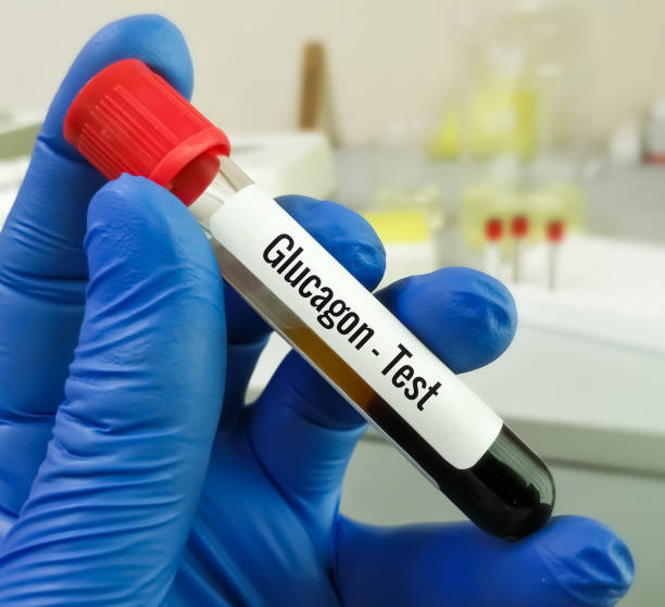 istock Blood sample for Glucagon test. Pancretitis. 1424340824