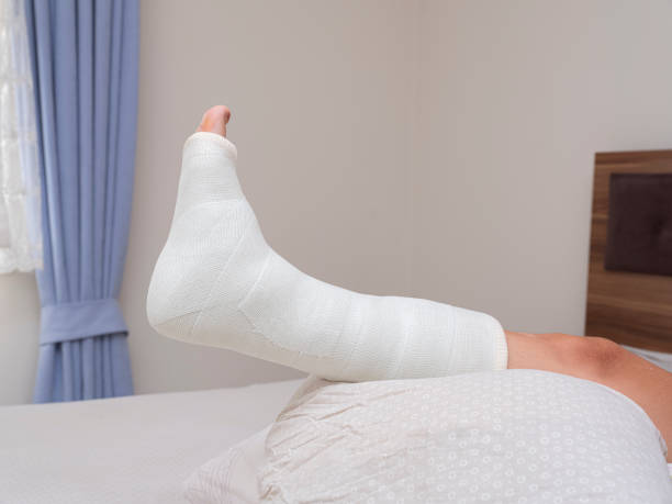 istock ankle and foot splint Bandages on the legs. 1424471004