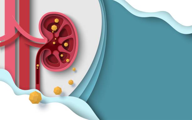 illustrazioni stock, clip art, cartoni animati e icone di tendenza di calcoli renali umano malattia renale vettore sfondo - kidney stone