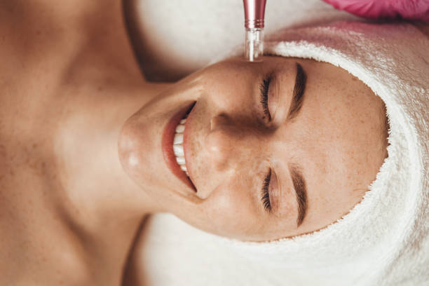sommersprossiges frauengesicht, das eine mesotherapie-injektion mit derma penen auf dem gesicht zur verjüngung auf dem spa-salon erhält. schönheit frau gesichtshautpflege. gesundheitsfürsorge, schönheitsbehandlung. professioneller schönheitssalon. - kollageninduktionstherapie stock-fotos und bilder