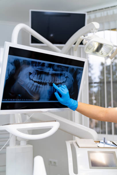 istock Teeth professional examining x ray. Dentistry radiography treatment. 1424644165