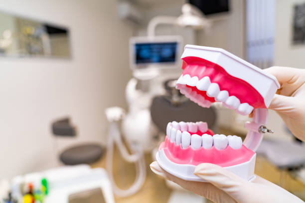 istock Plastic anatomical model of a human jaw. Teeth plastic example. 1424660295