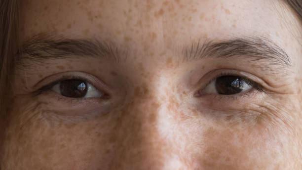 istock Freckled young woman looking at camera, cropped closeup face view 1424679254