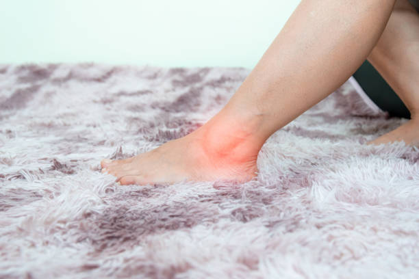 istock ankle inflammation of the human foot bones 1424821870
