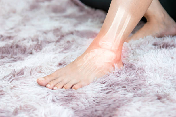 istock ankle inflammation of the human foot bones 1424821873