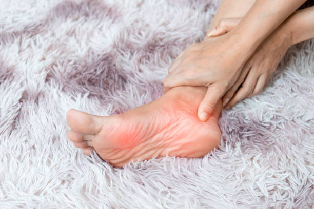 istock soles inflammation of the human foot bones 1424821875
