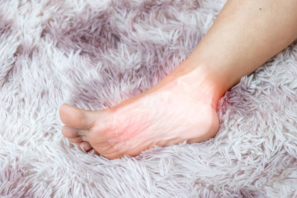 istock soles inflammation of the human foot bones 1424821876