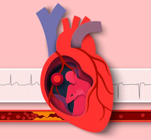 Heart attack paper cut vector cardiology disease Heart attack paper cut vector. Cardiology disease medical poster. Anatomy of human cardiovascular organ abstract design and cardiogram, atherosclerotic vessel illustration cholesterol screening stock illustrations