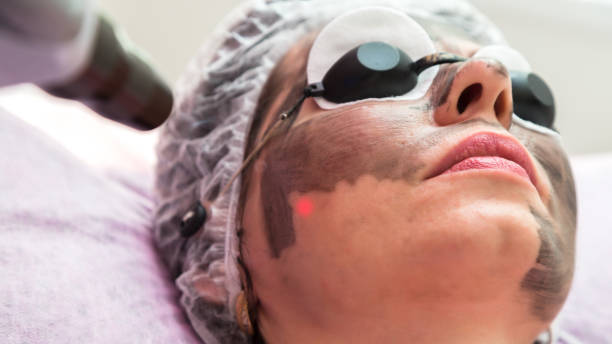 A woman in protective glasses with a smeared black mask on her face is undergoing a procedure in a beauty salon