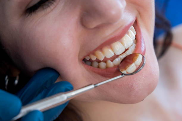 istock Woman Having Teeth Examined 1425133045