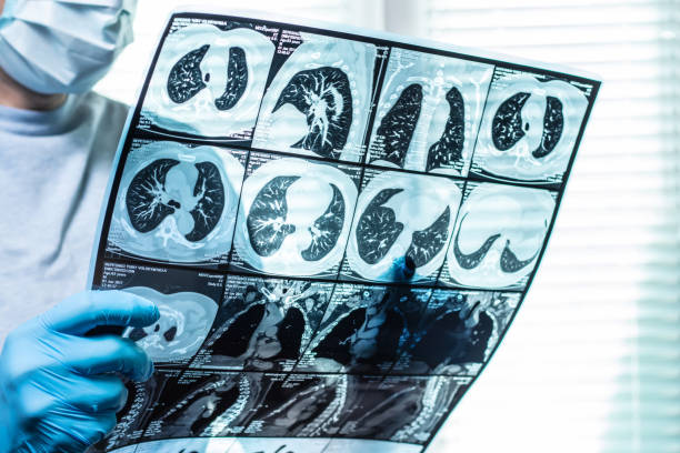 istock Doctor examining MRI image in hospital 1425164343