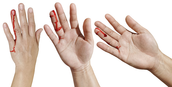 bloody woman's hand Represents injuries, accidents on a white background