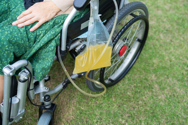 patiente asiatique assise sur un fauteuil roulant avec un sac d’urine dans le service hospitalier, concept médical sain - foley photos et images de collection