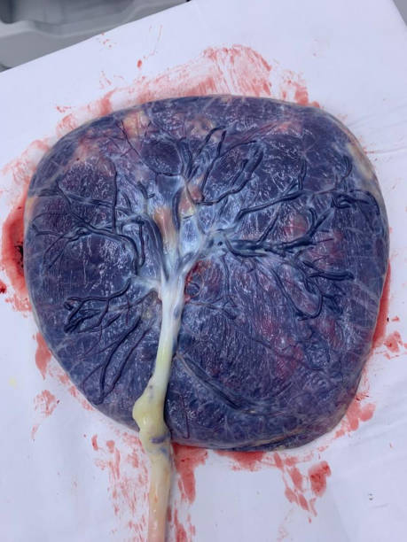 分娩室での出生後、臍帯を有する胎盤。 - blood human vein animal vein human blood vessel ストックフォトと画像