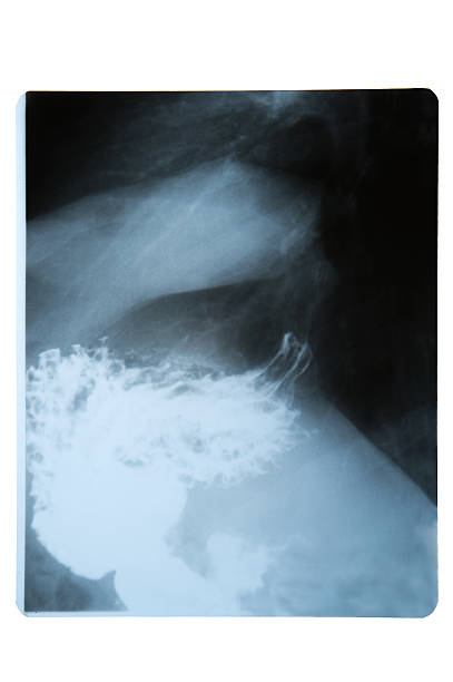 imagen de rayos x de estómago - cat scan abdomen medical scan x ray fotografías e imágenes de stock