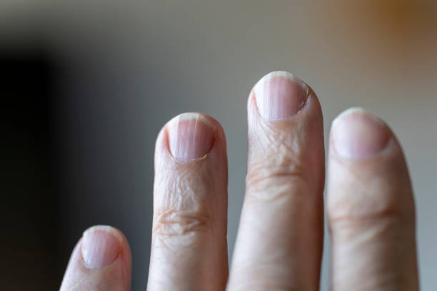 A senior man's fingers on left hand