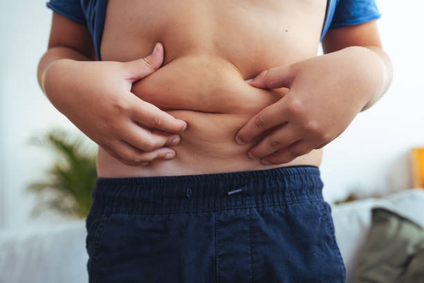 teenager-junge, der seinen schlaffen bauch hält und hebt - child obesity stock-fotos und bilder