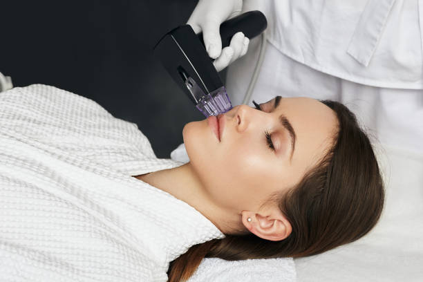 mujer morena recibiendo procedimiento de levantamiento de radiofrecuencia para su rejuvenecimiento de la piel de la cara en la clínica de cosmetología estética - morpheus fotografías e imágenes de stock