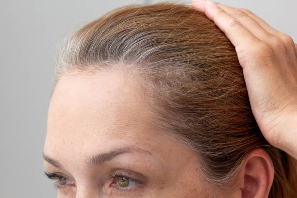 istock Woman head with hand on grey hair 1425963106