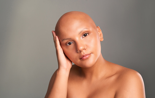 Portrait of a woman with cancer or alopecia in a studio for survivor empowerment and motivation. Hope, hair loss and strong girl with a bald head from chemotherapy or medical treatment in oncology.
