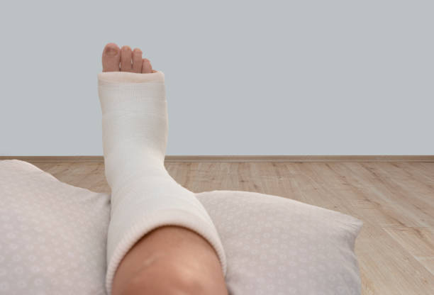 istock ankle and foot splint Bandages on the legs. 1426172216