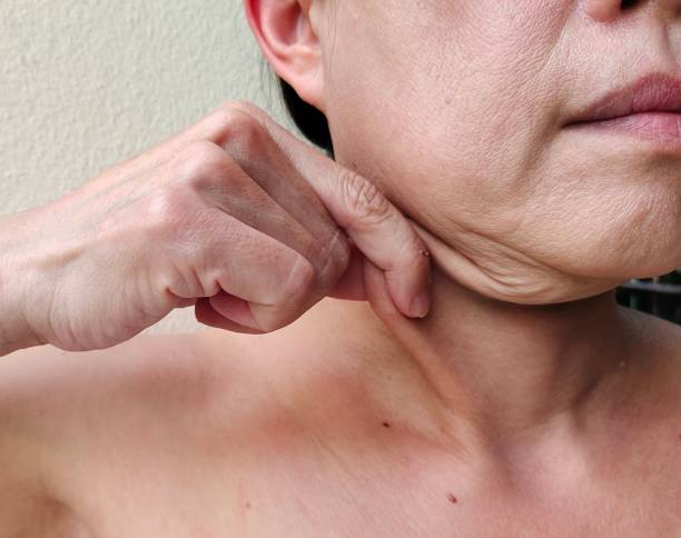 neck muscles begin weakening