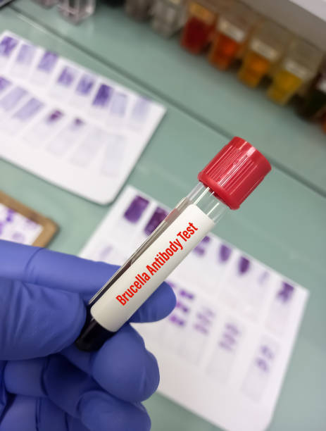 próbka krwi do testu na przeciwciała brucella w diagnostyce brucelozy. - blood sample blood tube pathologist zdjęcia i obrazy z banku zdjęć
