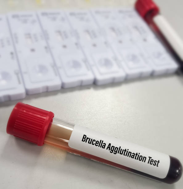 istock Blood sample for Brucella agglutination test to diagnosis of brucellosis. 1426879406