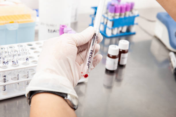 istock Scientist preparing bone marrow samples for flow cytometric analysis in the laboratory. 1426917318