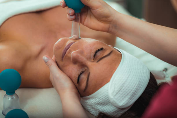 Cupping therapy, ventosa cupping face treatment in a beauty salon stock photo