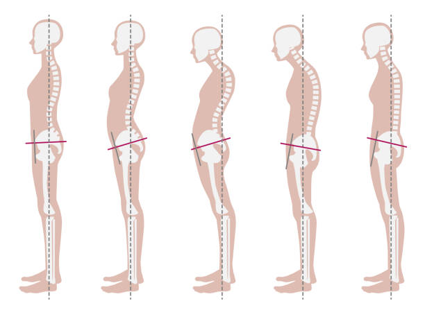 illustrazioni stock, clip art, cartoni animati e icone di tendenza di campione scheletrico di buona e cattiva postura - human spine chiropractic adjustment back pain