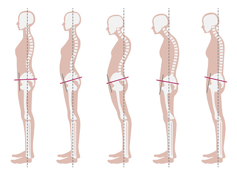 Skeletal sample of good and bad posture