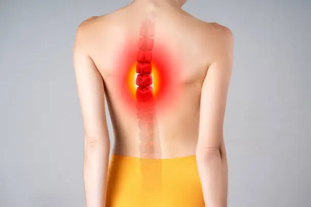 Photo of Intervertebral spine hernia, pain between the shoulder blades, woman suffering from backache at home, spinal disc disease