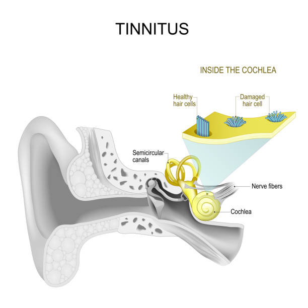 ilustrações, clipart, desenhos animados e ícones de zumbido. orelha humana. - tinitus