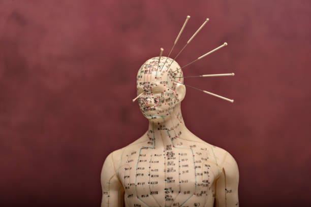 acupuncture model with needles in the head. stock photo